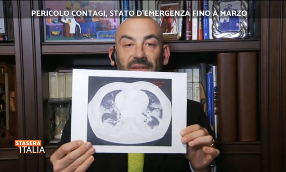 Bassetti mostra le tac dei pazienti non vaccinati: "Non doveva ricapitare, ora siamo in piena quarta ondata"