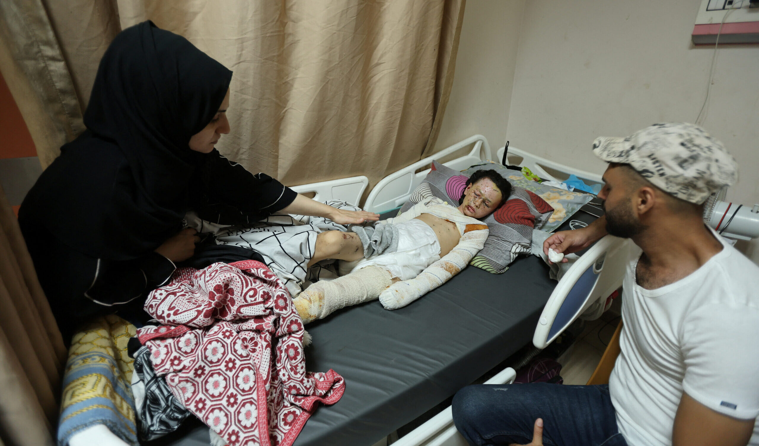 Storia di Hanan Akel, 10 anni, con il volto e il corpo bruciato e sfigurato dalle bombe israeliane